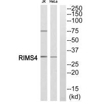 Western blot analysis of extracts from JK cells and Hela cells, using RIMS4 antiobdy. Western blot analysis of extracts from JK cells and Hela cells, using RIMS4 antiobdy.