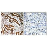 Immunohistochemistry analysis of paraffin-embedded human colon carcinoma tissue, using MEN1 antibody.