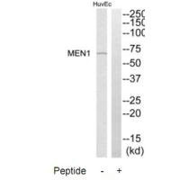 Western blot analysis of extracts from HuvEc cells, using MEN1 antibody. Western blot analysis of extracts from HuvEc cells, using MEN1 antibody.