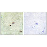 Immunohistochemistry analysis of paraffin-embedded human brain tissue using TRIM59 antibody.