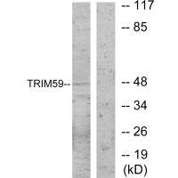 Western blot analysis of extracts from NIH-3T3 cells, using TRIM59 antibody. Western blot analysis of extracts from NIH-3T3 cells, using TRIM59 antibody.