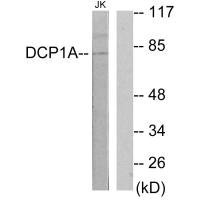 Western blot analysis of extracts from Jurkat cells, using DCP1A antibody. Western blot analysis of extracts from Jurkat cells, using DCP1A antibody.