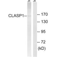 Western blot analysis of extracts from Jurkat cells, using CLASP1 antibody. Western blot analysis of extracts from Jurkat cells, using CLASP1 antibody.