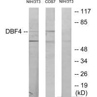 Western blot analysis of extracts from NIH-3T3 cells treated with H2O2 (100uM, 30mins) and COS-7 cells treated with PMA (125mg/ml, 30mins), using DBF4 antibody. Western blot analysis of extracts from NIH-3T3 cells treated with H2O2 (100uM, 30mins) and COS-7 cells treated with PMA (125mg/ml, 30mins), using DBF4 antibody.