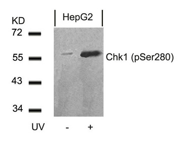 Western blot analysis of extracts from HepG2 cells untreated or treated with UV using Chk1(Phospho-Ser280) Antibody. Western blot analysis of extracts from HepG2 cells untreated or treated with UV using Chk1(Phospho-Ser280) Antibody.