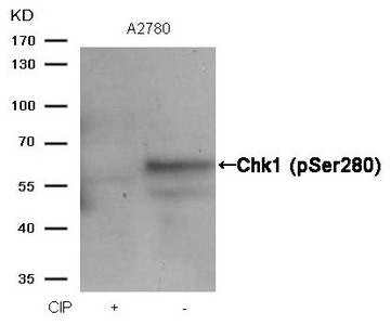 Western blot analysis of extracts from A2780 cells, treated with calf intestinal phosphatase (CIP), using Chk1 (Phospho-Ser280) Antibody.