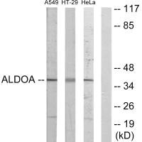 Western blot analysis of extracts from A549 cells, HT-29 cells and HeLa cells, using ALDOA antibody. Western blot analysis of extracts from A549 cells, HT-29 cells and HeLa cells, using ALDOA antibody.