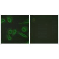 Immunofluorescence analysis of HeLa cells, using PECAM-1 (Ab-713) antibody.