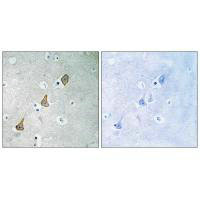 Immunohistochemistry analysis of paraffin-embedded human brain tissue using PECAM-1 (Ab-713) antibody. Immunohistochemistry analysis of paraffin-embedded human brain tissue using PECAM-1 (Ab-713) antibody.