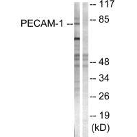 Western blot analysis of extracts from Jurkat cells, using PECAM-1 (Ab-713) antibody.