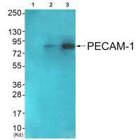 Western blot analysis of extracts from COS7 cells (Lane 2) and JK cells (Lane 3), using PECAM-1 (Ab-713) antiobdy. The lane on the left is treated with synthesized peptide.
