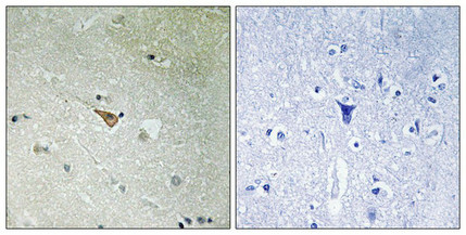 Immunohistochemical analysis of paraffin-embedded human brain tissue, using ALK (Phospho-Tyr1096) antibody (left)or the same antibody preincubated with blocking peptide (right). Immunohistochemical analysis of paraffin-embedded human brain tissue, using ALK (Phospho-Tyr1096) antibody (left)or the same antibody preincubated with blocking peptide (right).