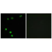 Immunofluorescence analysis of MCF-7 cells, using TP53INP2 antibody.