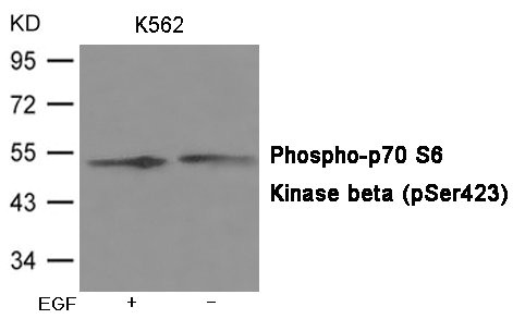 Western blot analysis of extracts from K562 cells untreated or treated with EGF, using Phospho-p70 S6 Kinase beta (Phospho-Ser423) Antibody.