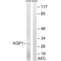 Western blot analysis of extracts from rat brain cells, using AQP1 antibody. Western blot analysis of extracts from rat brain cells, using AQP1 antibody.