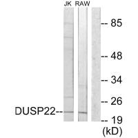 Western blot analysis of extracts from Jurkat cells and RAW264.7 cells, using DUSP22 antibody. Western blot analysis of extracts from Jurkat cells and RAW264.7 cells, using DUSP22 antibody.