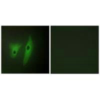 Immunofluorescence analysis of HeLa cells, using DUS19 antibody.