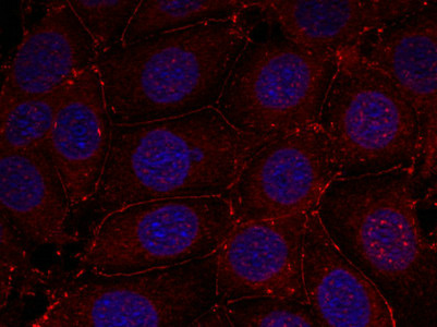 Immunofluorescence staining of methanol-fixed MCF7 cells using IGF-1R (phospho-Tyr1161) antibody.