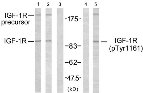 Western blot analysis using IGF-1R (Ab-1161) antibody (Line 1, 2 and 3) and IGF-1R (phospho-Tyr1161) antibody (Line 4 and 5). Western blot analysis using IGF-1R (Ab-1161) antibody (Line 1, 2 and 3) and IGF-1R (phospho-Tyr1161) antibody (Line 4 and 5).
