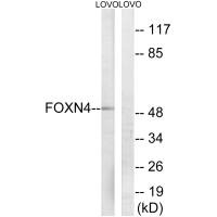 Western blot analysis of extracts from LOVO cells, using FOXN4 antibody. Western blot analysis of extracts from LOVO cells, using FOXN4 antibody.
