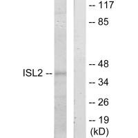 Western blot analysis of extracts from 293 cells, using ISL2 antibody. Western blot analysis of extracts from 293 cells, using ISL2 antibody.