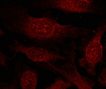 Immunofluorescence staining of methanol-fixed Hela cells showing cytoplasmic and nuclear staining using GSK3b(Ab-9) Antibody.