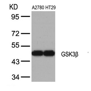 Western blot analysis of extracts from A2780 and HT29 cells using GSK3b(Ab-9) Antibody. Western blot analysis of extracts from A2780 and HT29 cells using GSK3b(Ab-9) Antibody.