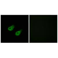 Immunofluorescence analysis of HeLa cells, using JIP3 antibody.