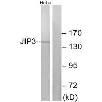 Western blot analysis of extracts from HeLa cells, using JIP3 antibody. Western blot analysis of extracts from HeLa cells, using JIP3 antibody.
