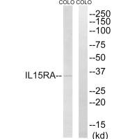 Western blot analysis of extracts from COLO cells, using IL15RA antibody.