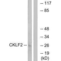 Western blot analysis of extracts from K562 cells, using CKLF2 antibody. Western blot analysis of extracts from K562 cells, using CKLF2 antibody.