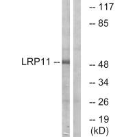 Western blot analysis of extracts from Jurkat cells, using LRP11 antibody. Western blot analysis of extracts from Jurkat cells, using LRP11 antibody.