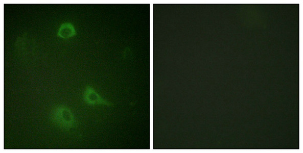 Immunofluorescence staining of methanol-fixed A549 cells using NMDAR1 (Phospho-Ser890) Antibody.