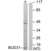 Western blot analysis of extracts from Jurkat cells, using BUD31 antibody. Western blot analysis of extracts from Jurkat cells, using BUD31 antibody.