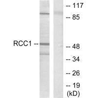 Western blot analysis of extracts from HepG2 cells, using Retinoic Acid Receptor beta antibody.