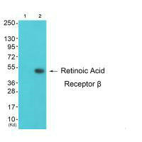 Western blot analysis of extracts from K562 cells (Lane 2), using Retinoic Acid Receptor beta antiobdy. The lane on the left is treated with synthesized peptide.