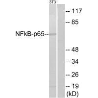 Western blot analysis of extracts from NIH-3T3, using NF-kappaB p65 (Ab-311) antibody.