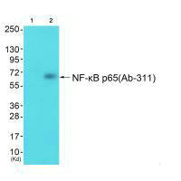 Western blot analysis of extracts from cos-7 cells (Lane 2), using NF-kappaB p65 (Ab-311) antiobdy. The lane on the left is treated with synthesized peptide.