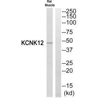 Western blot analysis of extracts from Rat Muscle cells, using KCNK12 antibody. Western blot analysis of extracts from Rat Muscle cells, using KCNK12 antibody.