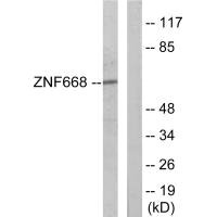Western blot analysis of extracts from Jurkat cells, using ZNF668 antibody. Western blot analysis of extracts from Jurkat cells, using ZNF668 antibody.