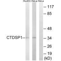 Western blot analysis of extracts from HUVEC cells and HeLa cells, using CTDSP1 antibody. Western blot analysis of extracts from HUVEC cells and HeLa cells, using CTDSP1 antibody.