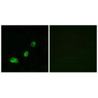 Immunofluorescence analysis of MCF-7 cells, using ACOT1 antibody.