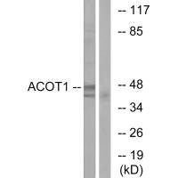 Western blot analysis of extracts from Jurkat cells, using ACOT1 antibody.