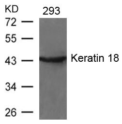 Western blot analysis of extracts from 293 cells using Keratin 18(Ab-33) Antibody.