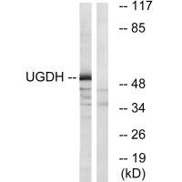 Western blot analysis of extracts from COLO cells, using UGDH antibody.