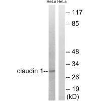 Western blot analysis of extracts from HeLa cells, treated with Hu (2nM, 24hours), using Claudin 1 (Ab-210) antibody.