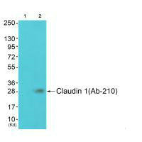 Western blot analysis of extracts from JK cells (Lane 2), using Claudin 1 (Ab-210) antiobdy. The lane on the left is treated with synthesized peptide.