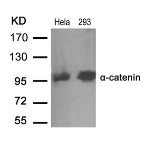 Western blot analysis of extracts from Hela and 293 cells using a-catenin(Ab-641) antibody. Western blot analysis of extracts from Hela and 293 cells using a-catenin(Ab-641) antibody.