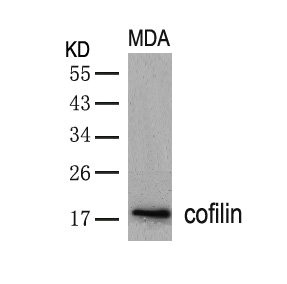 Western blot analysis of extracts from MDA cells using cofilin(Ab-3) Antibody. Western blot analysis of extracts from MDA cells using cofilin(Ab-3) Antibody.