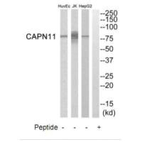 Western blot analysis of extracts from HepG2 cells, Jurkat cells and HuvEc cells, using CAPN11 antibody.